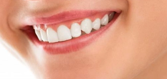التخلص من تراكم الجير على الأسنان دون زيارة الطبيب