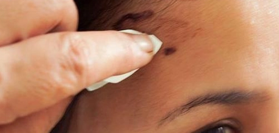تنظيف البشرة من آثار الصبغة