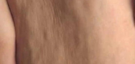 وداعاً للسيلوليت: دليل شامل للتخلص منه