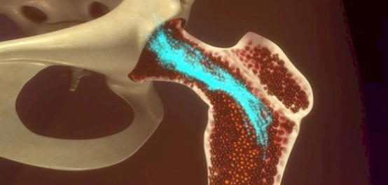 دليل شامل لنخاع العظم: الموقع، الأنواع، الوظائف، والأمراض