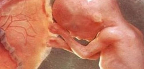 موقع الجنين في الشهر الخامس: دليل شامل