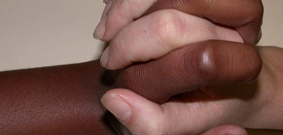 صبغة الميلانين: مواقعها، تكوينها، وأنواعها