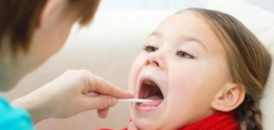 عملية استئصال اللوزتين: كل ما تحتاج معرفته