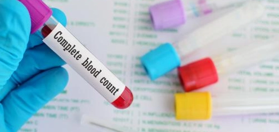 أسباب ارتفاع تحليل RDW-CV ودواعي إجرائه