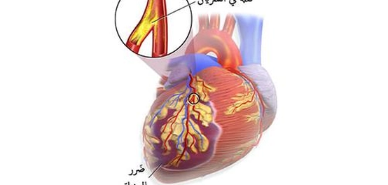 ارتجاع صمام القلب: الأسباب، الأنواع، والعلاج
