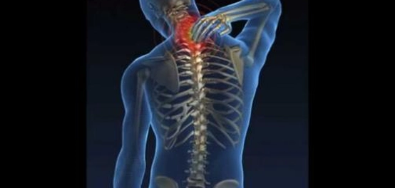 علاج الانزلاق الغضروفي بدون تدخل جراحي: طرق ونصائح