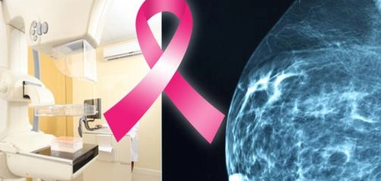 دور العلاج الإشعاعي في مكافحة سرطان الثدي