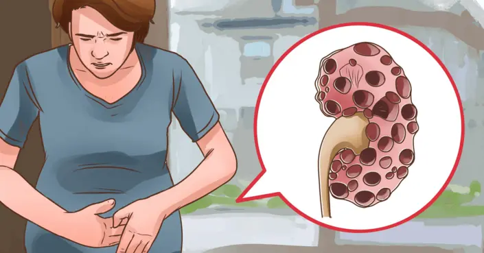 أعراض الفشل الكلوي: 6 علامات حاسمة ودليلك لحماية الكلى