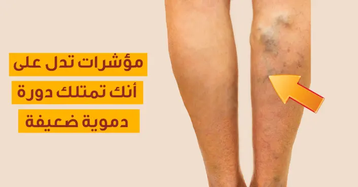 ضعف الدورة الدموية: دليلك الشامل لأعراضها، أسبابها، وطرق علاجها الفعالة