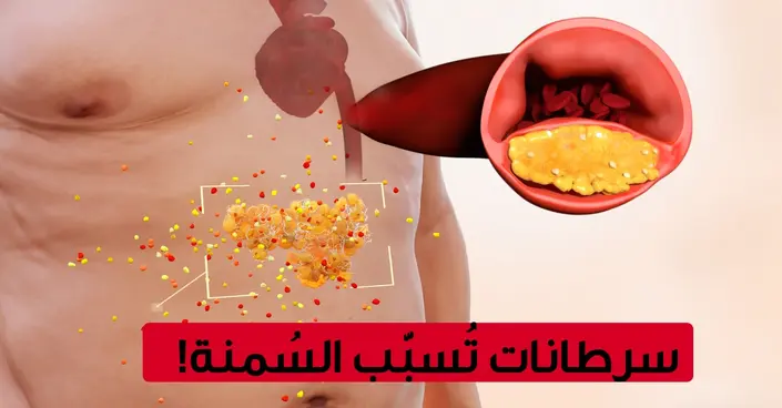السمنة والسرطان: 13 نوعاً من السرطانات ترتبط بزيادة الوزن.. هل أنت في خطر؟