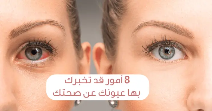 عيناك تتحدث: 8 أمور مدهشة تخبرك بها عيونك عن صحتك العامة