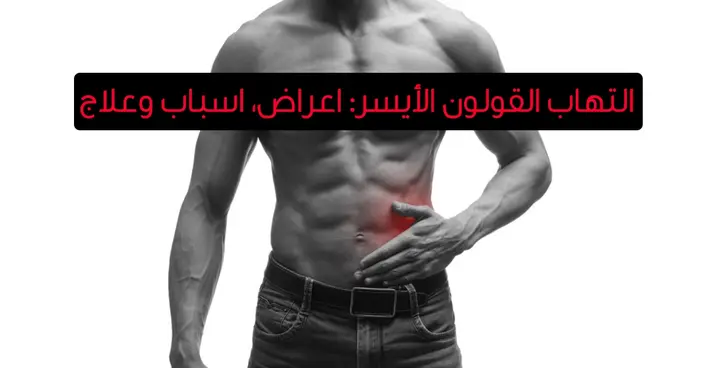 التهاب القولون الأيسر: دليلك الشامل للأعراض، الأسباب، والعلاجات الحديثة