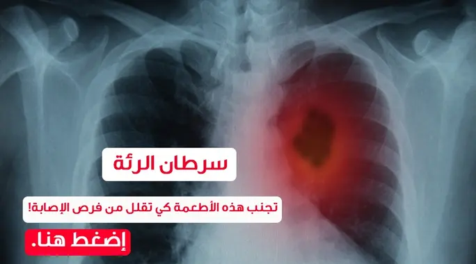 نظامك الغذائي وسرطان الرئة: أطعمة عليك تجنبها لتقليل المخاطر
