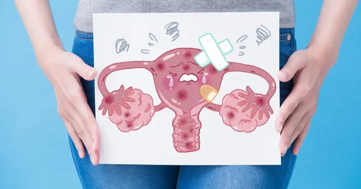 ضعف المبايض: دليل شامل للأسباب، الأعراض، وطرق العلاج الفعالة