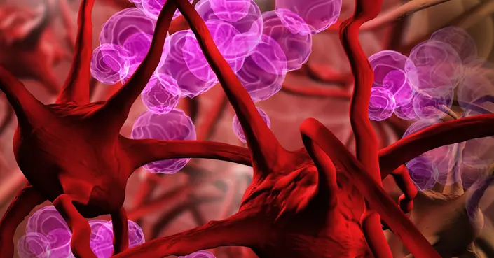 علاج فقر الدم: دليل شامل لأبرز الطرق والأساليب الفعالة