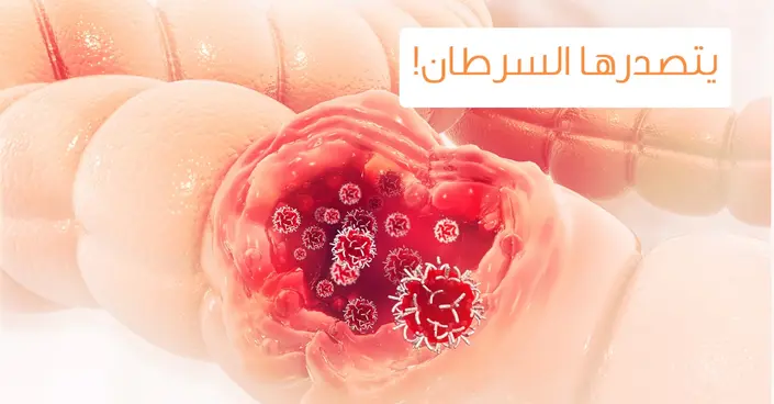 أمراض القولون: دليل شامل لفهمها، أعراضها، وأهمية الوقاية من سرطان القولون