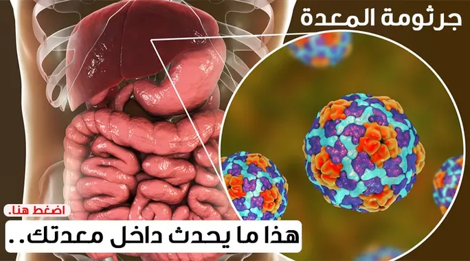 جرثومة المعدة: دليلك الشامل للوقاية والعلاج الفعال