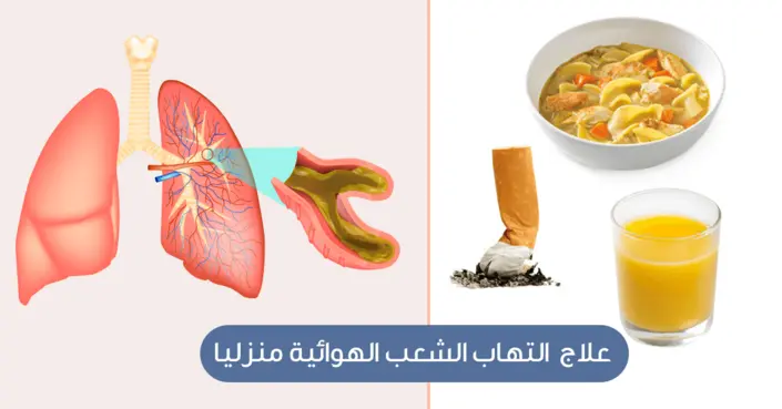 عالج التهاب الشعب الهوائية منزلياً: دليل شامل للتعافي السريع