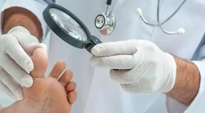دليلك الشامل لفطريات الجلد: الأنواع، الأعراض، الوقاية والعلاج