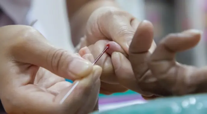 الثلاسيميا في الوطن العربي: دليلك الشامل للوقاية والعلاج