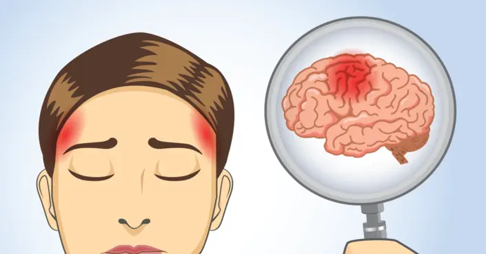 لا تتجاهله: 10 حالات خطيرة يدل عليها الصداع وتتطلب انتباهك الفوري