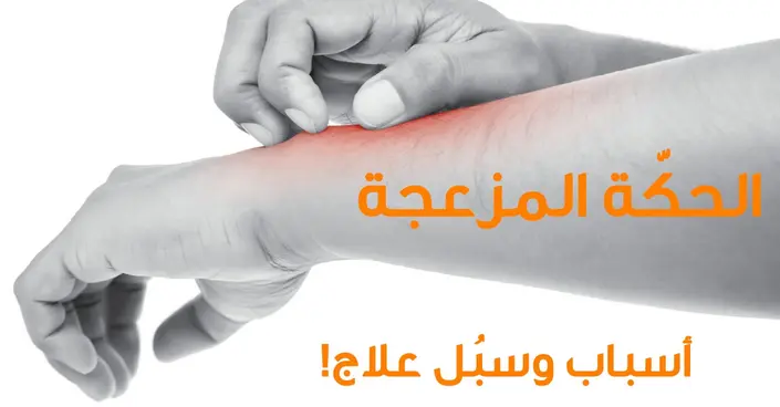 التخلص من الحكة المزعجة: دليلك الشامل لوصفات طبيعية وحلول فعالة