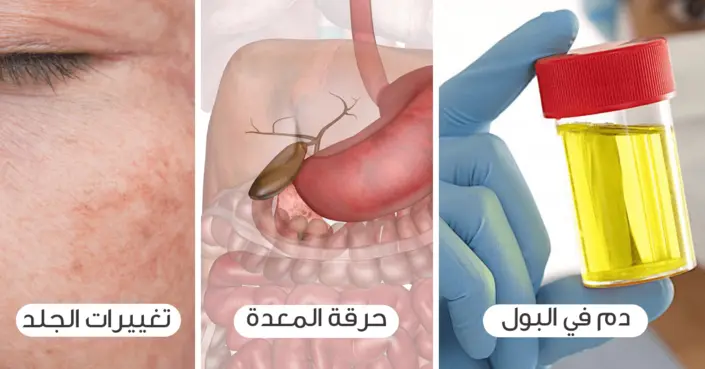 10 أعراض للسرطان عند النساء: علامات لا يجب تجاهلها لصحة أفضل
