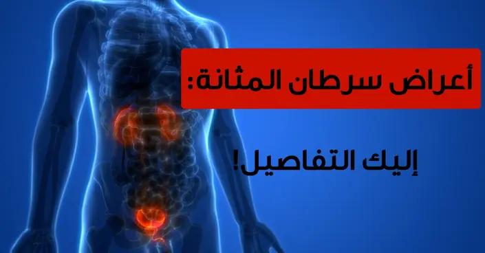 أعراض سرطان المثانة: علامات مبكرة ومتقدمة يجب أن تعرفها