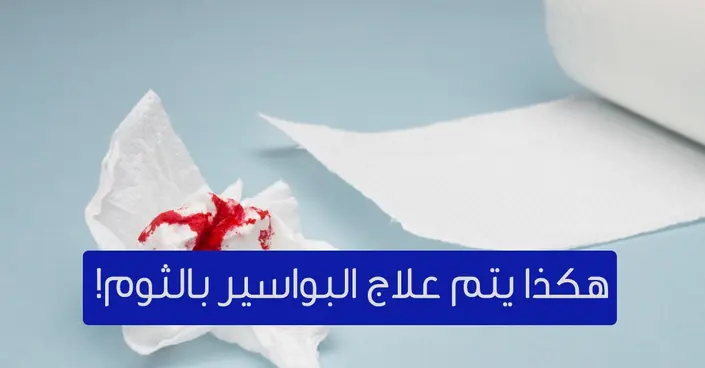 علاج البواسير بالثوم: حقيقة أم خرافة؟ كل ما تحتاج معرفته
