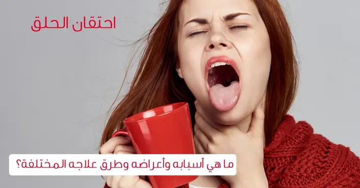 احتقان الحلق: دليلك الشامل للأسباب، الأعراض، والعلاج الفعال