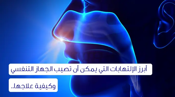 دليلك الشامل: أبرز التهابات الجهاز التنفسي الشائعة وكيفية التعامل معها