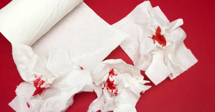 دليل شامل: ناسور الأمعاء &#8211; الأعراض، الأسباب، والعلاج الفعال