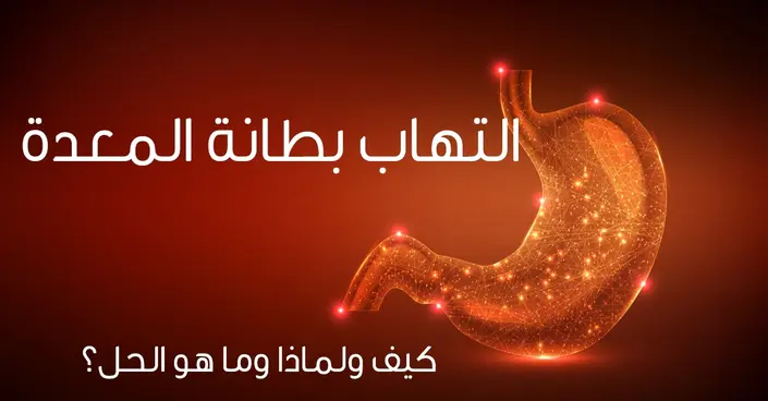 التهاب الغشاء الداخلي للبطن (التهاب الصفاق): دليلك الشامل للأسباب، الأعراض والعلاج