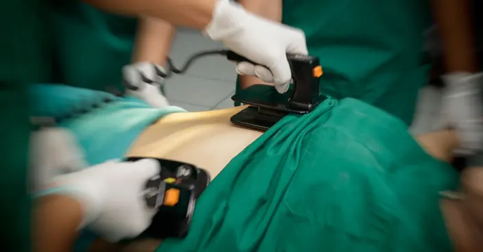 بطء القلب: دليل شامل لفهم الأسباب والأعراض والعلاج