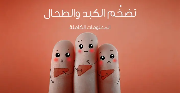 تضخم الكبد والطحال: الأسباب، الأعراض، والعلاج الفعال