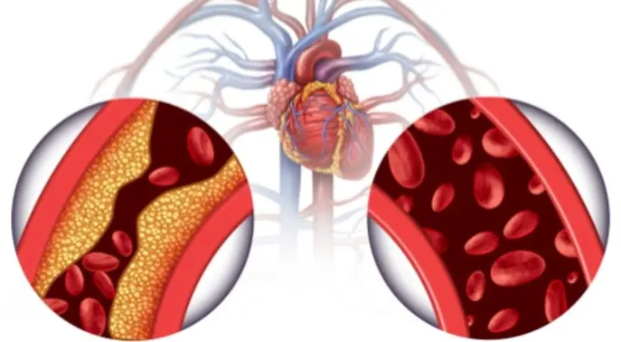 15 مرضًا يصيب جهاز الدوران: دليل شامل لأبرز أمراض القلب والأوعية الدموية