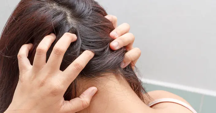 أمراض جلدية تصيب فروة الرأس: دليلك الشامل للأسباب، العلاج، والوقاية