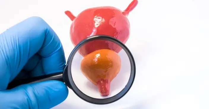 التهاب البروستاتا: دليلك الشامل للأعراض، الأسباب، وخيارات العلاج