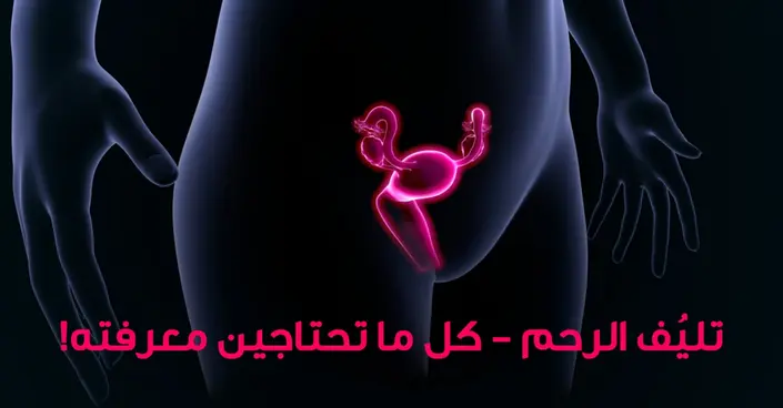 تليف الرحم: دليلك الشامل لفهم الأعراض، الأسباب، والعلاج الفعال