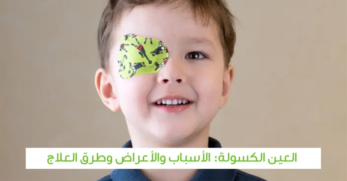 العين الكسولة: دليلك الشامل للأسباب، الأعراض، وطرق العلاج الفعّالة