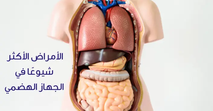 الأمراض الأكثر شيوعًا في الجهاز الهضمي: دليلك الشامل للأسباب والوقاية