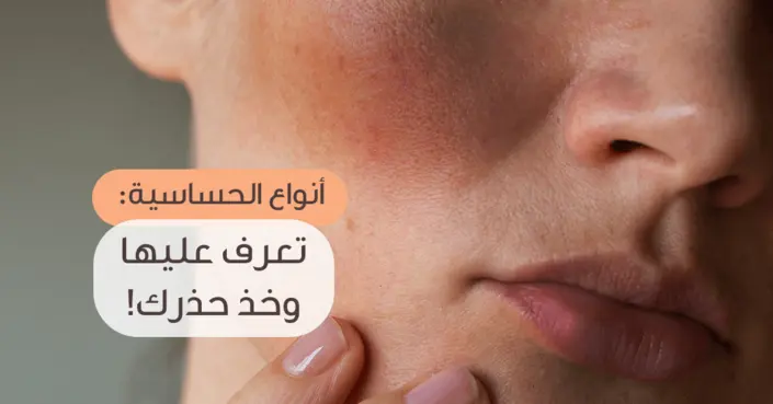 أنواع الحساسية: دليلك الشامل لفهمها والتعامل معها بفعالية