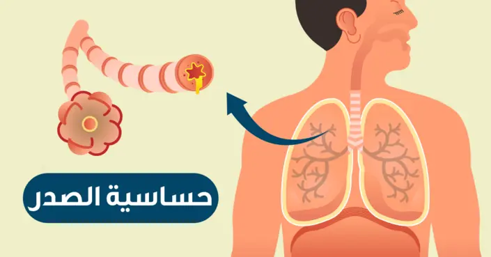 حساسية الصدر: دليلك الشامل للأعراض، الأسباب، والعلاج الفعال