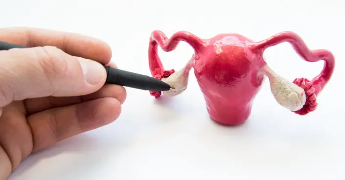 دليل شامل: علاج تكيس المبايض بالأعشاب والطرق الطبيعية لتعزيز صحتك الهرمونية