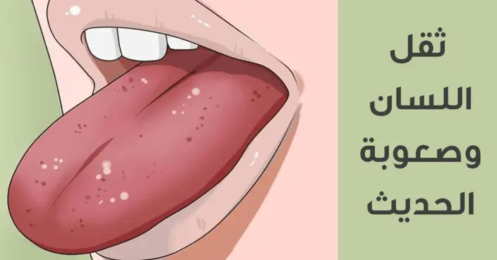 ثقل اللسان وصعوبة الحديث: فهم الأسباب والعلاجات المحتملة