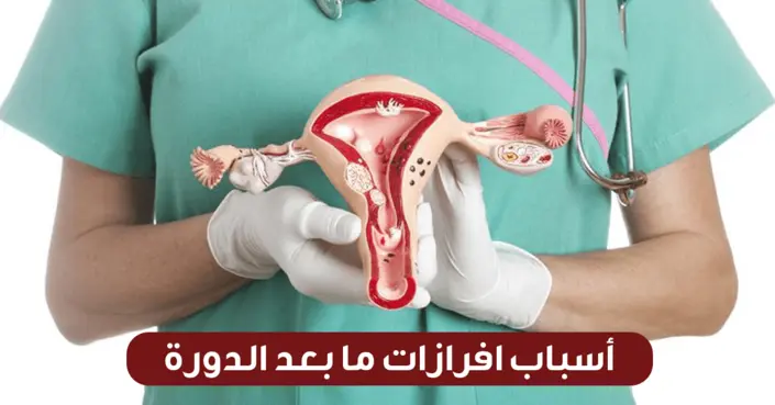 أسباب إفرازات ما بعد الدورة: دليل شامل لأنواعها ودلالاتها
