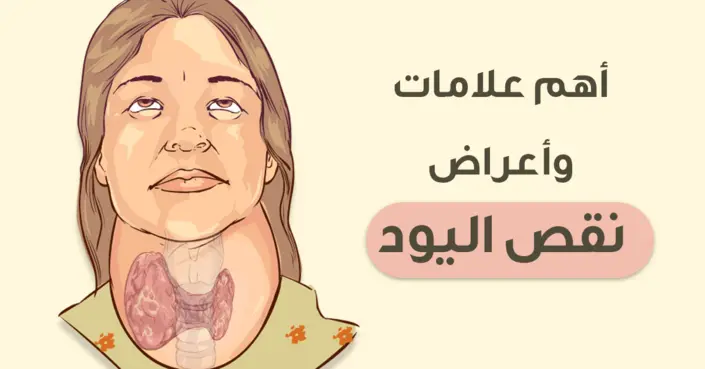 دليلك الشامل لعلامات وأعراض نقص اليود: متى يجب الانتباه؟