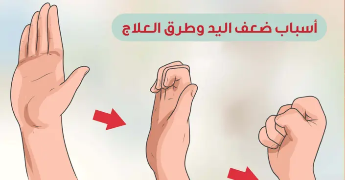 ضعف اليدين: فهم الأسباب الشائعة وخطوات العلاج الفعالة