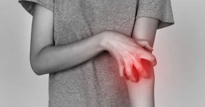 دليلك الشامل: أعراض الجرب وكيف تتخلص منها بفعالية وراحة
