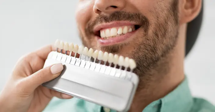 العدسات اللاصقة للأسنان: دليلك الشامل لابتسامة مثالية